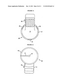 RESILIENT MEDICALLY INFLATABLE INTERPOSITIONAL ARTHROPLASTY DEVICE diagram and image