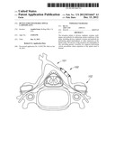 DEVICE FOR EXPANDABLE SPINAL LAMINOPLASTY diagram and image