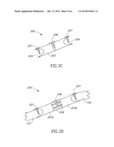 DEVICE FOR EXPANDABLE SPINAL LAMINOPLASTY diagram and image