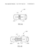 DEVICE FOR EXPANDABLE SPINAL LAMINOPLASTY diagram and image