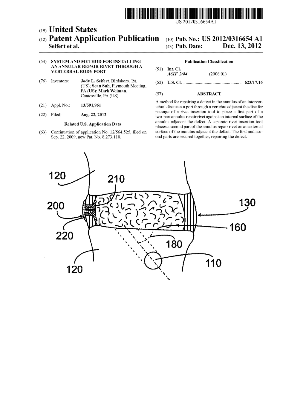 System and Method for Installing an Annular Repair Rivet Through a     Vertebral Body Port - diagram, schematic, and image 01