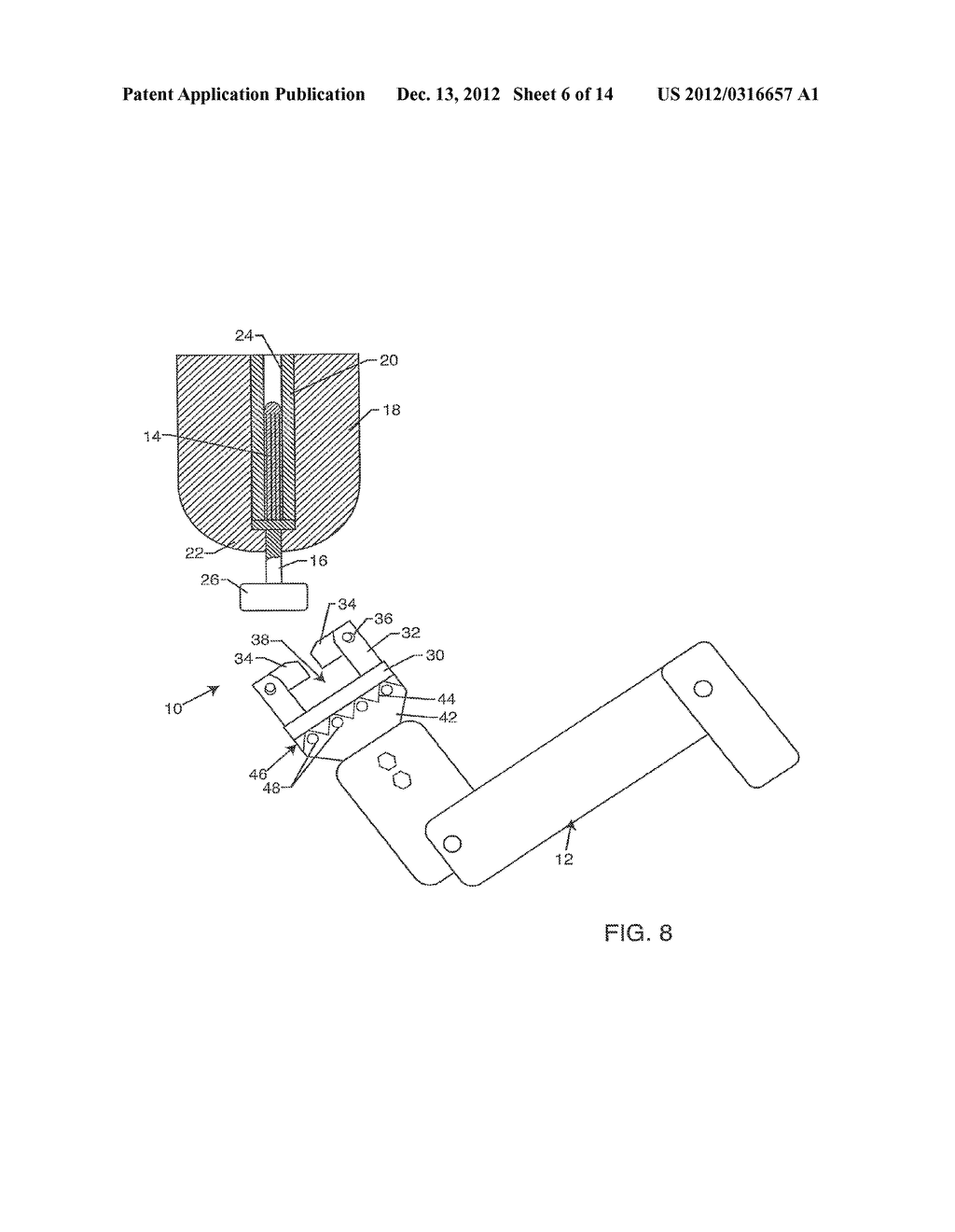 RELEASABLE ATTACHMENT SYSTEM FOR A PROSTHETIC LIMB - diagram, schematic, and image 07