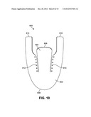 Method For Assembling A Tongue For An Article Of Footwear diagram and image