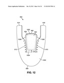 Method For Assembling A Tongue For An Article Of Footwear diagram and image