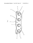 Exhaust Device diagram and image