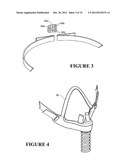 NASAL INTERFACE diagram and image