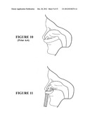 NASAL INTERFACE diagram and image