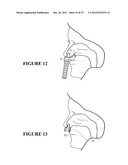 NASAL INTERFACE diagram and image