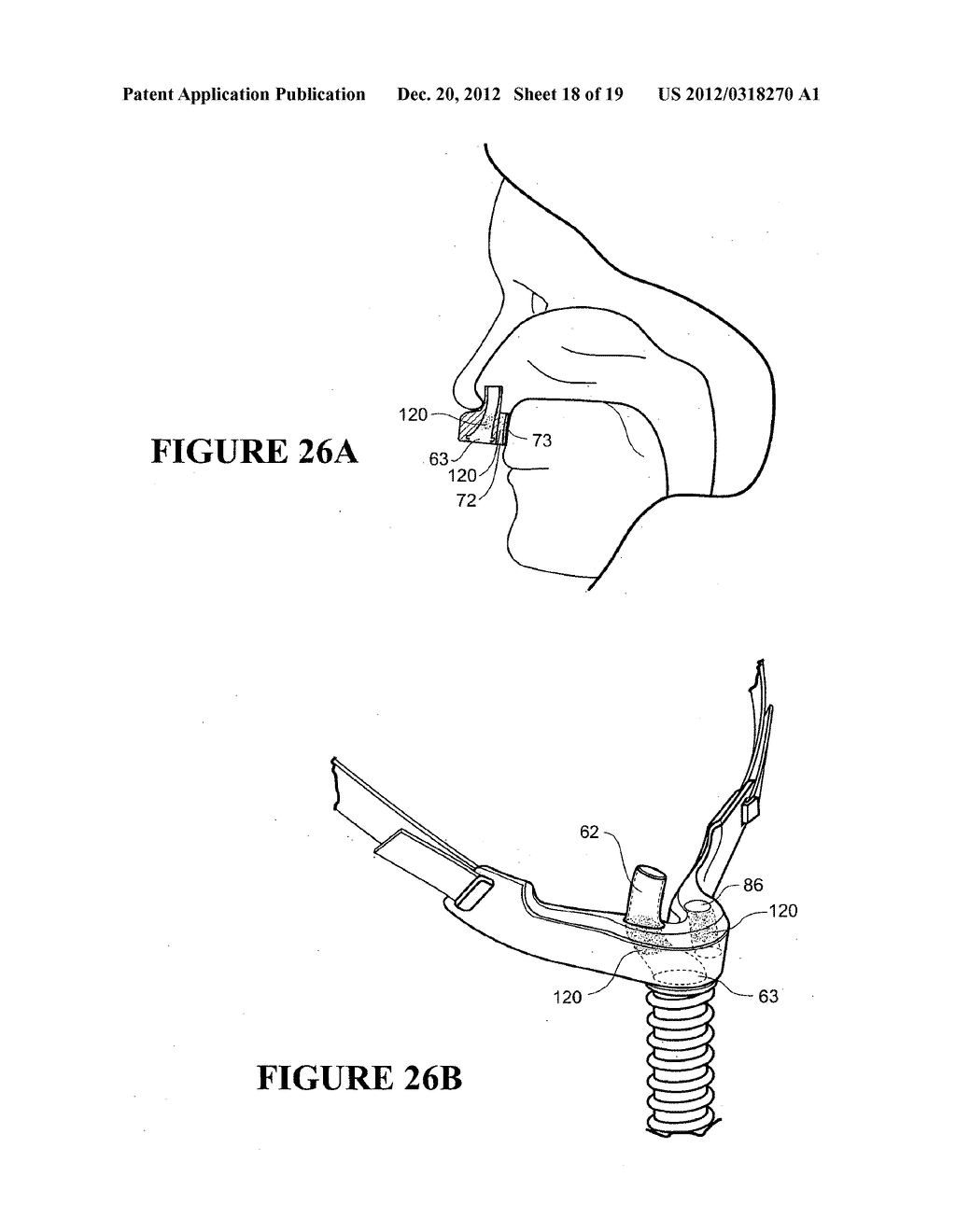 NASAL INTERFACE - diagram, schematic, and image 19