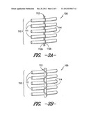 STRUCTURALLY SUPPORTED, NON-PNEUMATIC WHEEL WITH CONTINUOUS LOOP     REINFORCEMENT ASSEMBLY diagram and image