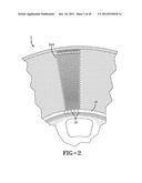 SYSTEM FOR NON-PNEUMATIC SUPPORT OF A VEHICLE diagram and image