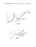 METHOD AND APPARATUS FOR REMOVING A FILM FROM A SURFACE diagram and image