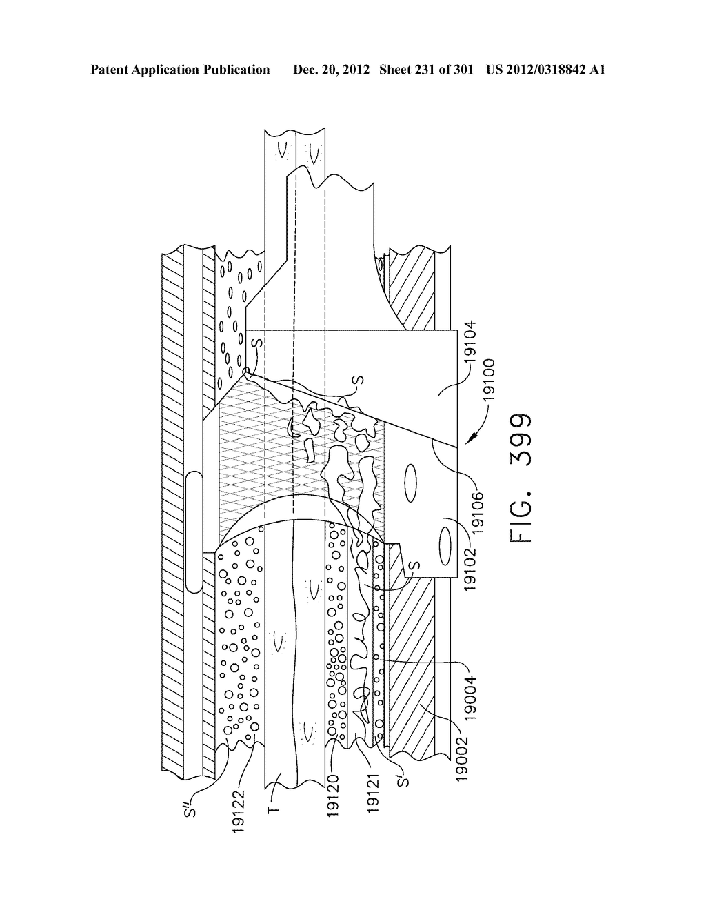 TISSUE STAPLER HAVING A THICKNESS COMPENSATOR COMPRISING INCORPORATING A     HEMOSTATIC AGENT - diagram, schematic, and image 232