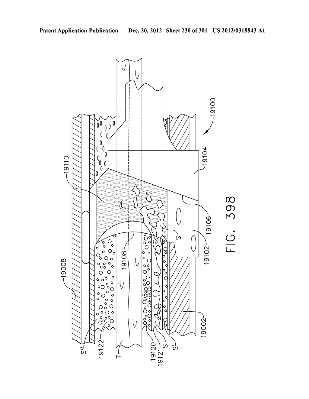 TISSUE STAPLER HAVING A THICKNESS COMPENSATOR INCORPORATING AN OXYGEN     GENERATING AGENT - diagram, schematic, and image 231