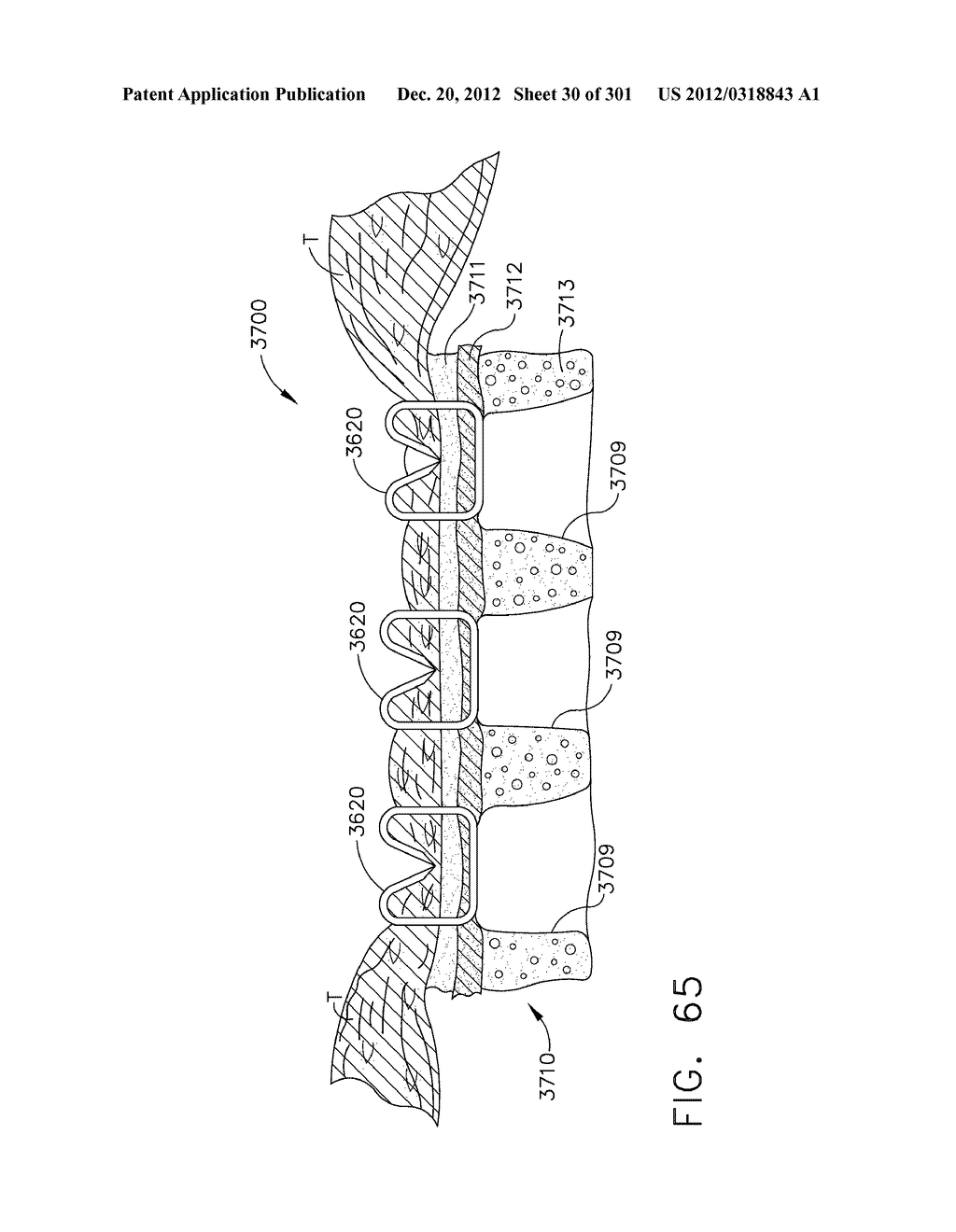 TISSUE STAPLER HAVING A THICKNESS COMPENSATOR INCORPORATING AN OXYGEN     GENERATING AGENT - diagram, schematic, and image 31