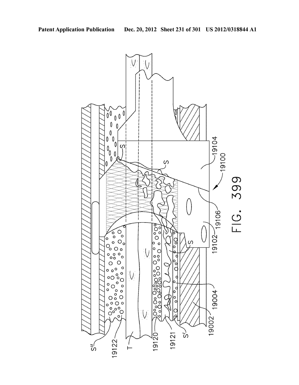 TISSUE STAPLER HAVING A THICKNESS COMPENSATOR INCORPORATING AN     ANTI-INFLAMMATORY AGENT - diagram, schematic, and image 232