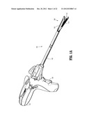 Surgical Stapling Apparatus diagram and image