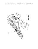 Surgical Stapling Apparatus diagram and image