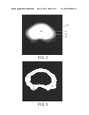 PROBABILISTIC REFINEMENT OF MODEL-BASED SEGMENTATION diagram and image