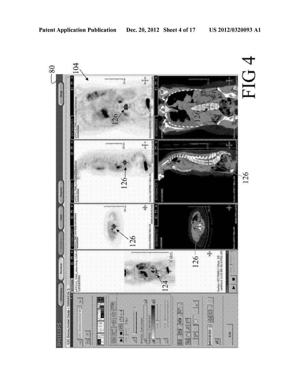 MULTI-MODALITY MEDICAL IMAGE VIEWING - diagram, schematic, and image 05