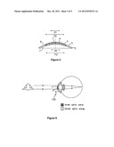 CONTACT LENSES FOR MYOPIC EYES AND METHODS OF TREATING MYOPIA diagram and image