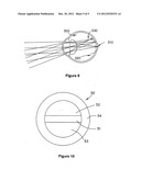 CONTACT LENSES FOR MYOPIC EYES AND METHODS OF TREATING MYOPIA diagram and image