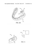 METHODS AND APPARATUS FOR PROCESSING AUDIO SIGNALS diagram and image