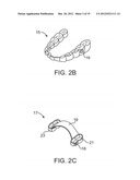 METHODS AND APPARATUS FOR PROCESSING AUDIO SIGNALS diagram and image