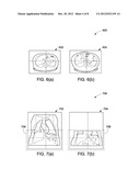 METHOD FOR AUTOMATIC MISMATCH CORRECTION OF IMAGE VOLUMES diagram and image