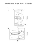 METHOD FOR AUTOMATIC MISMATCH CORRECTION OF IMAGE VOLUMES diagram and image