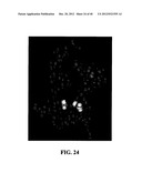 TREATMENT AND PROPHYLAXIS OF AMYLOIDOSIS diagram and image