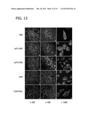 TARGETING THE NEUROMUSCULAR JUNCTION FOR TREATMENT diagram and image