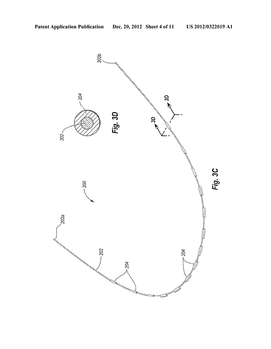 Customized Orthodontic Arch Wire Manufactured Using Model of Patient's     Teeth - diagram, schematic, and image 05