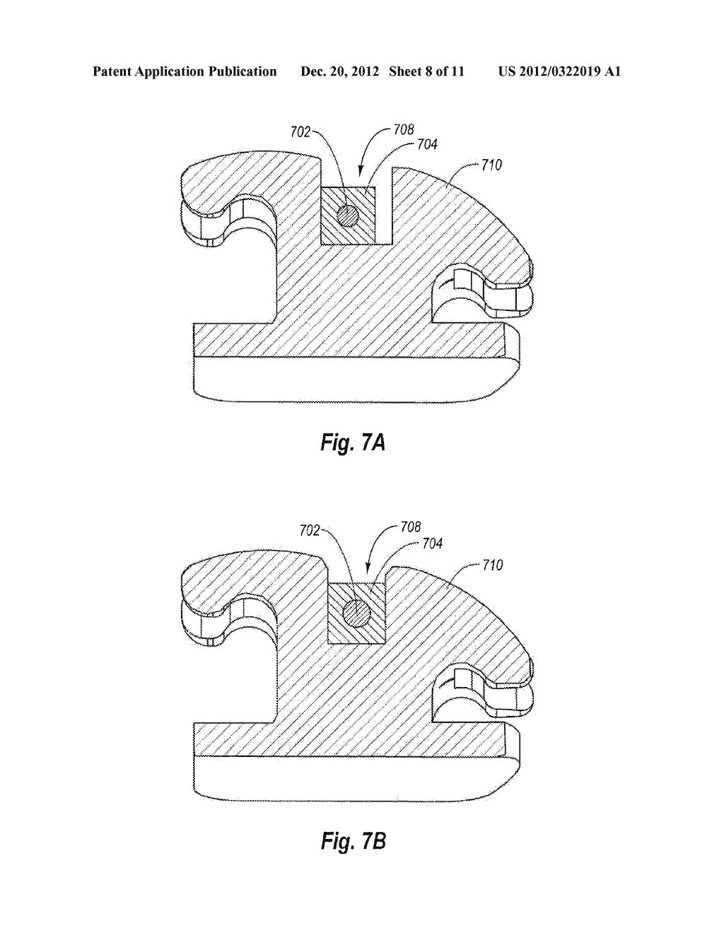 Customized Orthodontic Arch Wire Manufactured Using Model of Patient's     Teeth - diagram, schematic, and image 09