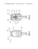 ORTHODONTIC ATTACHMENT BONDING TOOL AND METHOD OF USING SAME diagram and image