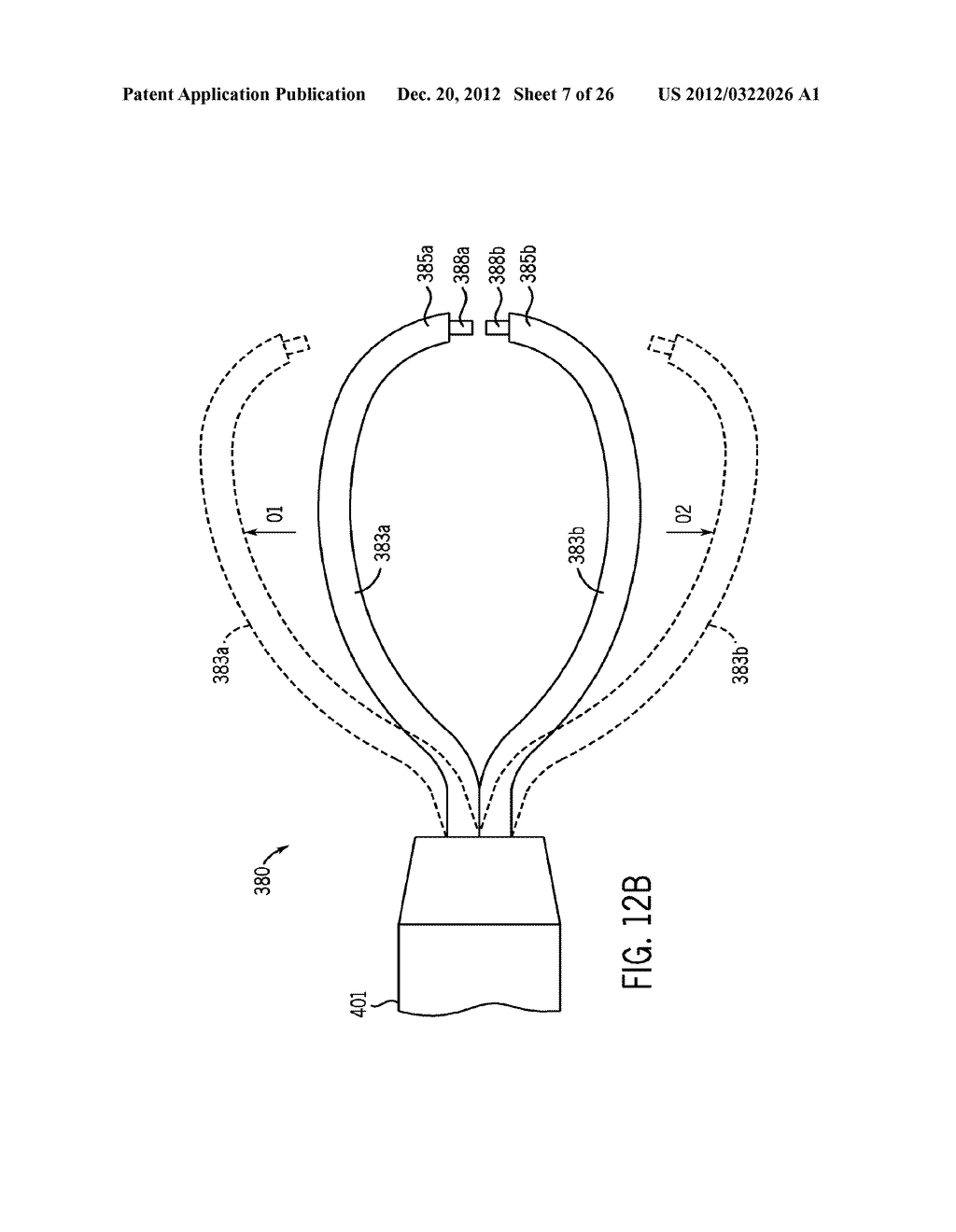 Dental Curing Lights and a Seamless, Single Load Cavity Preparation and     Filling Technique - diagram, schematic, and image 08