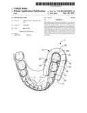 DENTAL ISOLATOR diagram and image