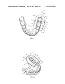 DENTAL ISOLATOR diagram and image