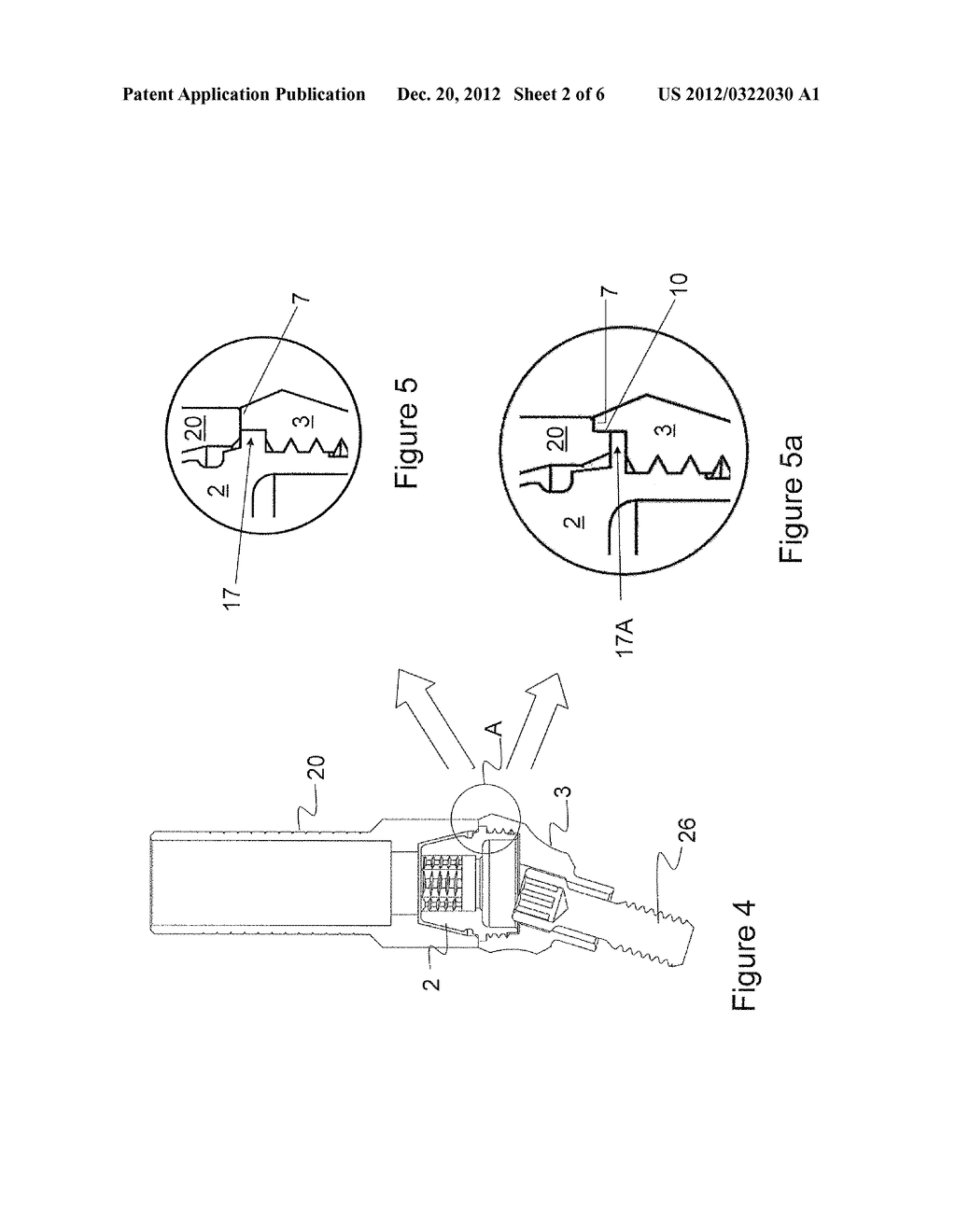 MODULAR ABUTMENT SYSTEM FOR TILTED DENTAL IMPLANTS - diagram, schematic, and image 03