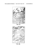 Materials and Methods for Assessing and Mapping Microbes and Microbial     Biofilms on Wounds diagram and image