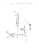 Methods and Apparatus for Measuring Analytes Using Large Scale FET Arrays diagram and image