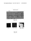 Methods And Compositions For Detection Of Cowden Syndrome (CS) and CS-Like     Syndrome diagram and image