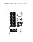 THERAPEUTIC AGENT FOR AUTOIMMUNE DISEASES OR ALLERGY, AND METHOD FOR     SCREENING FOR THE THERAPEUTIC AGENT diagram and image