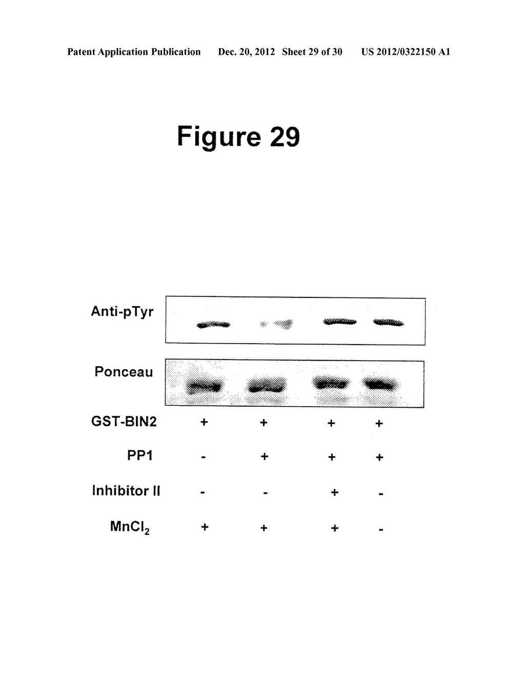 Mechanism and Method for Regulating Glycogen Synthase Kinase 3     (GSK3)-Related Kinases - diagram, schematic, and image 30