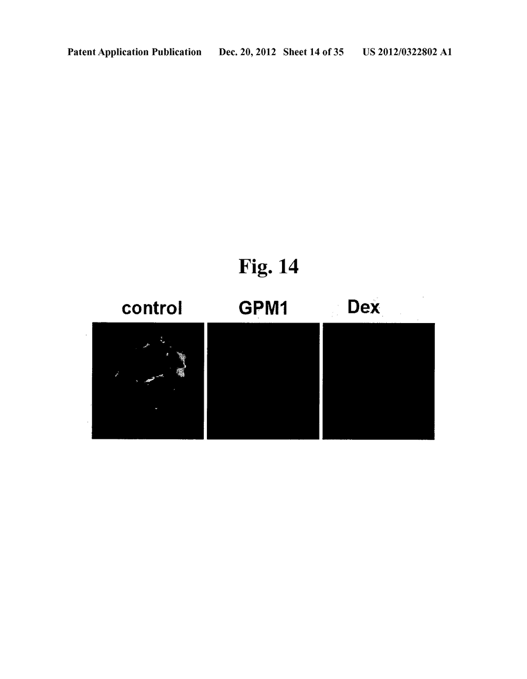 NOVEL 2, 4-PYRIMIDINE DERIVATIVES AND USE THEREOF - diagram, schematic, and image 15