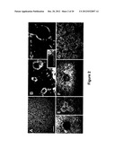 METHODS OF INHIBITING TUMOR CELL AGGRESSIVENESS USING THE MICROENVIRONMENT     OF HUMAN EMBRYONIC STEM CELLS diagram and image