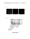 METHODS OF INHIBITING TUMOR CELL AGGRESSIVENESS USING THE MICROENVIRONMENT     OF HUMAN EMBRYONIC STEM CELLS diagram and image