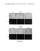 METHODS OF INHIBITING TUMOR CELL AGGRESSIVENESS USING THE MICROENVIRONMENT     OF HUMAN EMBRYONIC STEM CELLS diagram and image