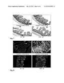 COMPOSITION FOR REPRESSION OF HYPERLIPIDEMIA AND OBESITY THROUGH     SUPPRESSION OF INTESTINAL CHOLESTEROL ABSORPTION diagram and image