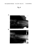 THERAPEUTIC AGENT FOR USE IN A METHOD OF TREATING PSORIASIS OR ATOPIC     DERMATITIS diagram and image